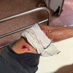 जानलेवा हमला मामले के दो गिरफ्तार